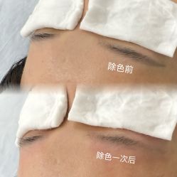 点击看大图 -Verywang半永久纹眉•仪器野生眉