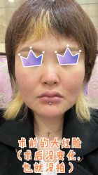 -美莱医疗美容医院