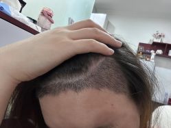 -碧莲盛·脱发养发中心