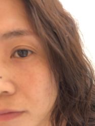 -长沙雅美医疗美容医院