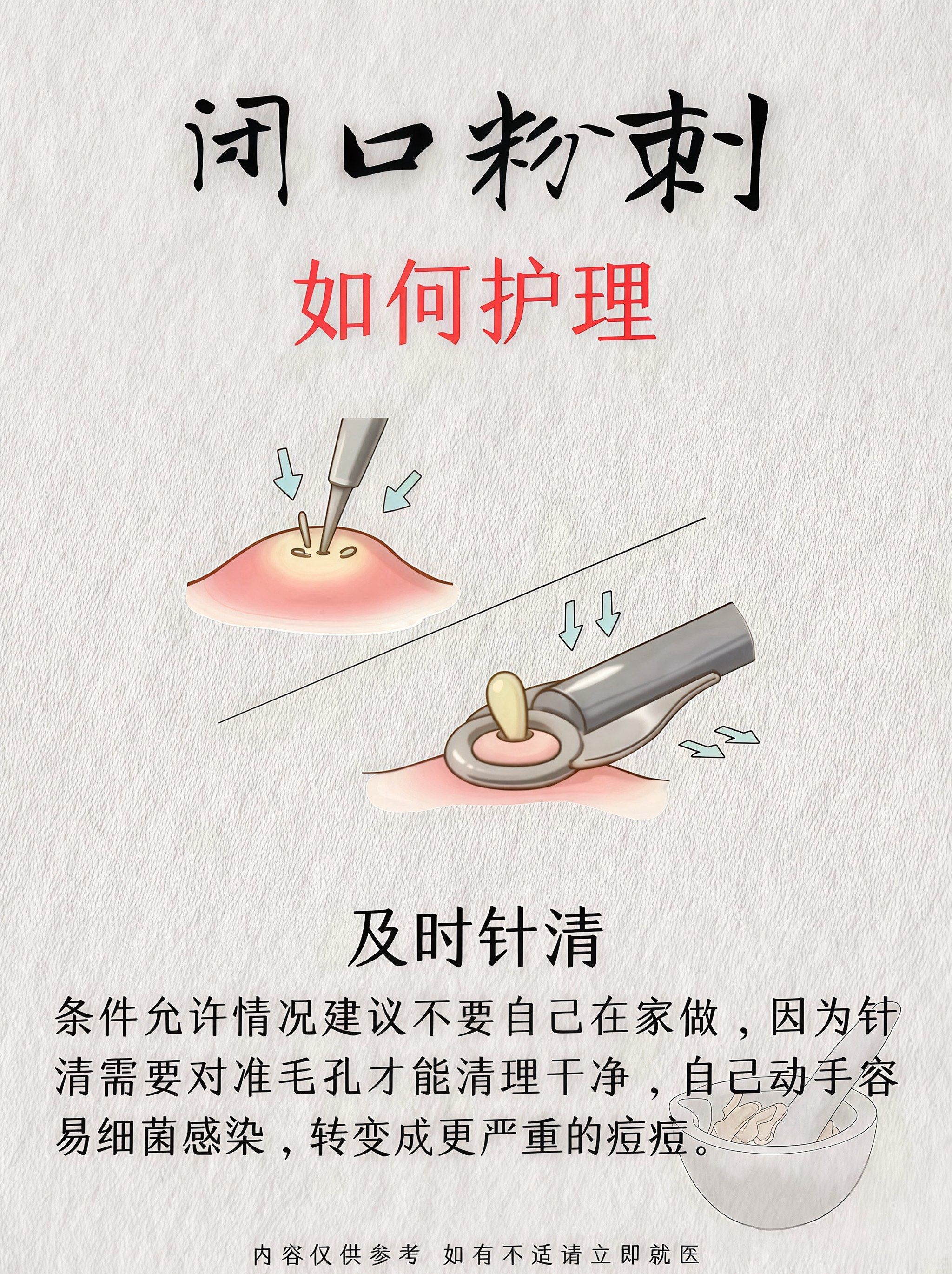 如何正确去闭口?