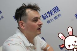 -大麦微针植发丨全国连锁