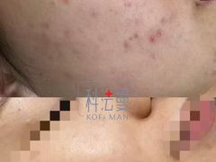 -上置·美兰优湖