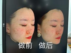 -北京英煌医疗美容·轻颜六区注射修复