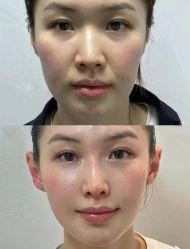 点击看大图 -Yestar艺星医疗美容医院