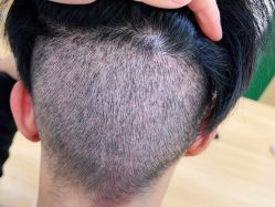 -雍禾植发全国连锁