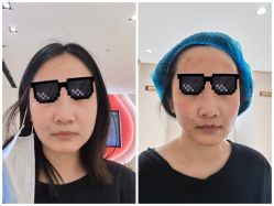 -广东韩妃整形外科医院