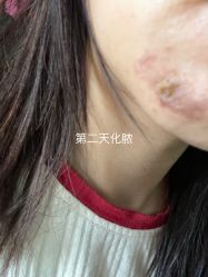 -圣嘉新医疗美容医院