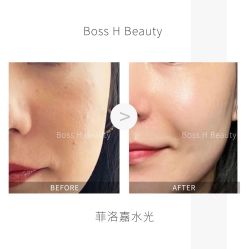 -Boss H Beauty美肌中心