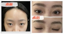 -素美医疗美容·西南眼鼻整形·修复基地