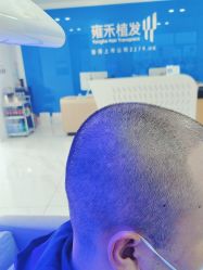 点击看大图 -雍禾植发
