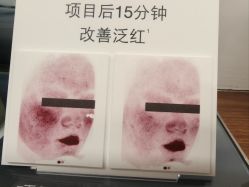 -JY·VALMONT法儿曼官方面护·海菲秀黑钻体验中心