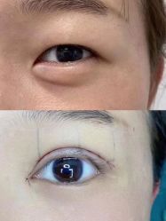 -素美医疗美容·西南眼鼻整形·修复基地