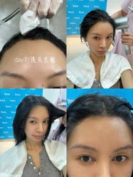 -雍禾植发全国连锁