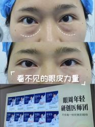 -天津健丽·去眼袋医疗美容机构