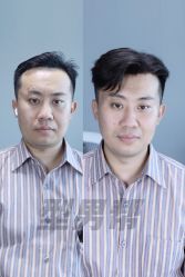-型男帮男士假发补发·佩戴式发型