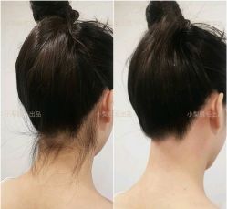 -小梨·OndaPro·专业脱毛连锁机构