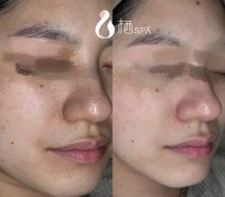 -栖SPA·ONDA ·海菲秀·皑皑科技美肤中心