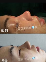 -北京米扬丽格医疗美容·联合丽格鼻整形中心