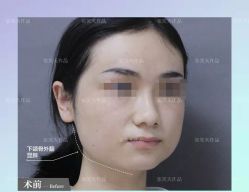 -圣嘉新医疗美容医院