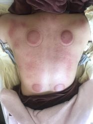 点击看大图 -伊童美家小儿推拿·中式养生(徐汇店)