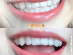 -团圆口腔·种植中心(锦江院区)