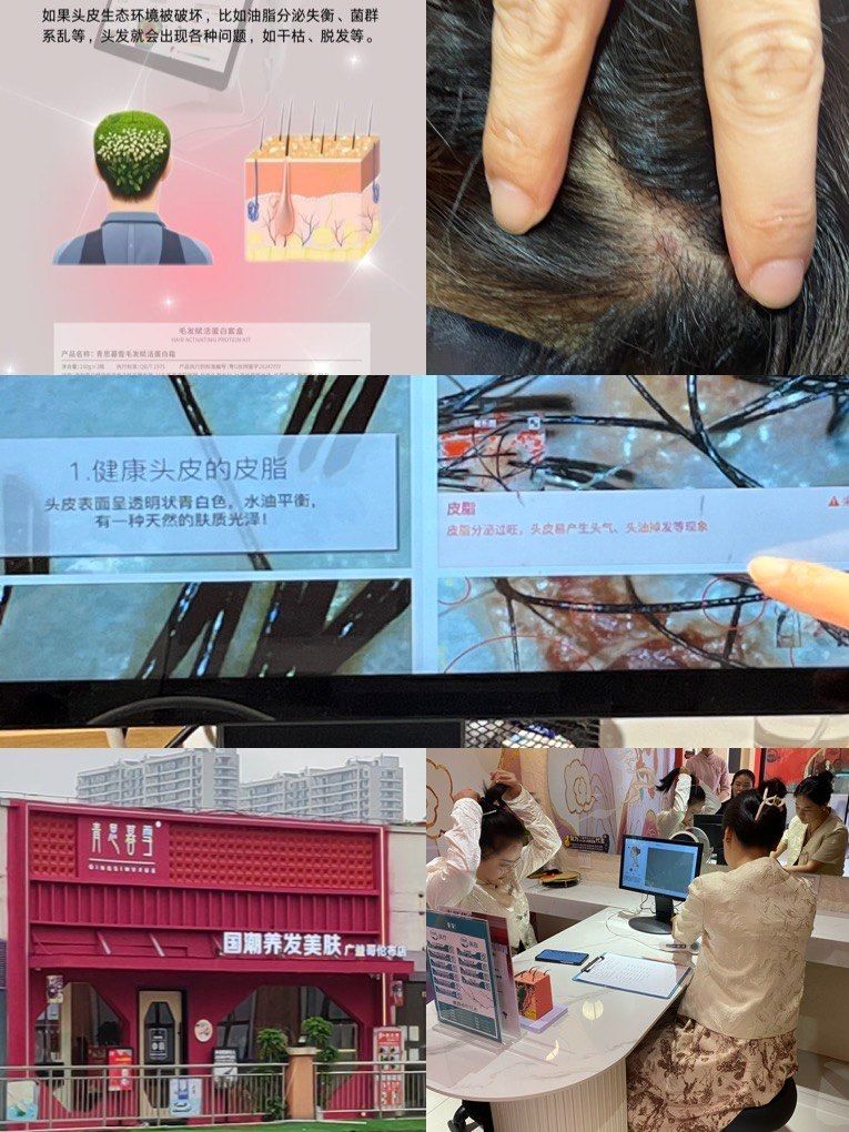 头皮结构大揭秘,你get了吗?清洁毛囊堵塞