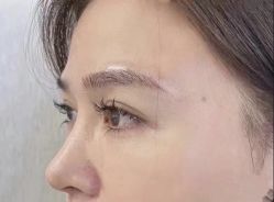 -杭州米兰柏羽医疗美容医院