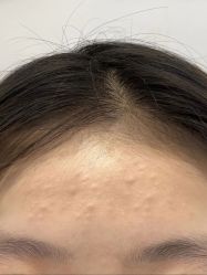 -LUNA皮相美·骨相美高级美感