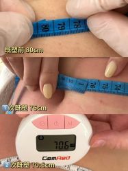 -HYOUNG 禾漾·BTL官方美学中心