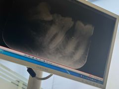 -北京大学口腔医院(第一门诊部)