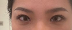 体验后-四川华美紫馨整形外科医院