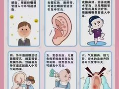 -自然之声助听器(平凉店)