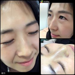 点击看大图 -光SPA科技美肤