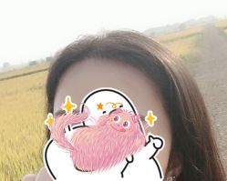 -大麦微针植发全国连锁