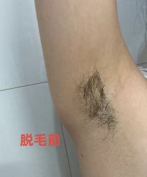 体验前-石家庄苏亚美联臣医疗美容医院