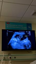 -杭州贝瑞斯美华妇儿医院·早孕·产检·儿科