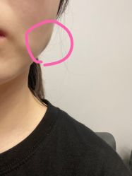 点击看大图 体验后-上海宏康医院·医疗美容科