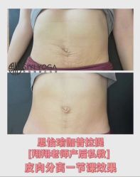 点击看大图 -思怡瑜伽·普拉提·减脂塑形