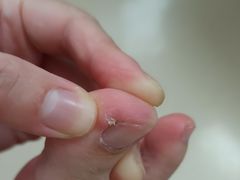 -郑远元专业修脚房(昌里东路店)