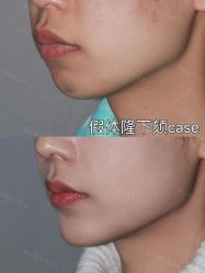 -北京米扬丽格医疗美容·联合丽格鼻整形中心