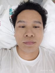 体验后-痘敏医生专业祛痘连锁