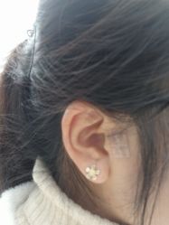 -肥三针腧穴瘦身馆