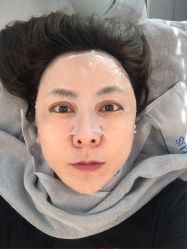 体验后-纯粹医美