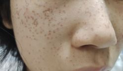 -MIACHIC蜜雅琦珂·美肌