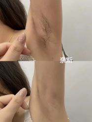 -闺蜜美甲