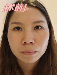 -素美医疗美容·西南眼鼻整形·修复基地