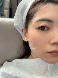 体验后-Dr.U博士医疗美容医院
