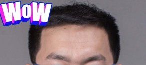 -大麦微针植发丨全国连锁