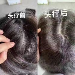 -希梵尔头皮抗衰·科技养发